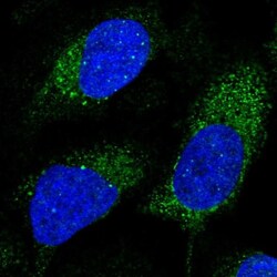 SLX4 Interacting Protein Antibody, Novus Biologicals:Antibodies:Primary